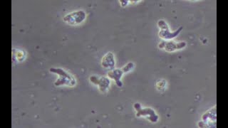 Naegleria fowleri under a microscope in realtime [upl. by Genovera]