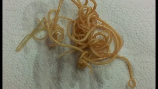 Roundworms in Dogs Toxocara canis amp Toxascaris leonina [upl. by Marrin923]