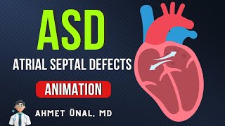 ❤ IS PFO A TYPE OF ASD  🎬 ATRIAL SEPTAL DEFECTS ASD ANIMATION [upl. by Esilahs]