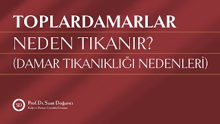 Toplardamarlar Neden Tıkanır Damar Tıkanıklığı Nedenleri [upl. by Laefar]