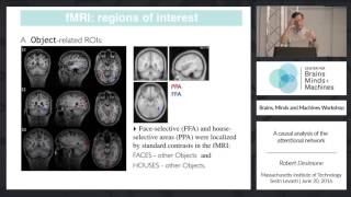 A Causal Analysis of the Attentional Network [upl. by Alard]