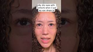 My dry eyes with contacts when I put my eye drops in thank you for saving me I was so thirsty [upl. by Newmark]