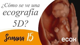 Ecografia de 15 semanas de embarazo Increíble 😮 [upl. by Cookie]