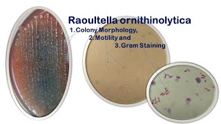 Raoultella ornithinolytica Colony Morphology Motility and Gram Staining [upl. by Eleirbag133]