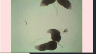 Drosophila Ovarian Dissection for Immunohistochemistry [upl. by Adile]