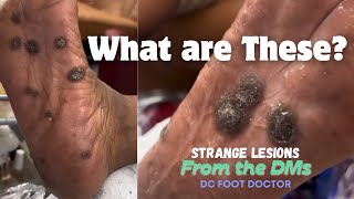 Strange Lesions From The DMs Episode 5 [upl. by Akeimat]