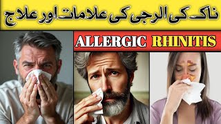 ALLERGIC Rhinitis And Its Treatment  Naak Ki Allergy Ka Ilaj  DrKashif Bilal [upl. by Leivad]