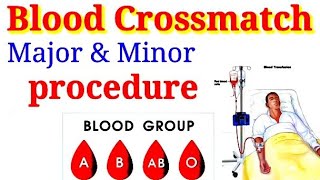 what is cross matching blood [upl. by Kilah]