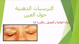 الترسبات الدهنية حول العين اللويحة الصفراء 🔹اسبابها 🔸علاجها 🔹xanthelasma [upl. by Cleasta]