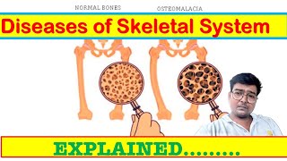 Possible Diseases of Bone and their symptoms [upl. by Romeon]