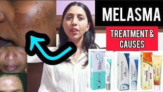 What is Melasma  How to cure Melasma  amp Causes Explained  Mrunali Chaudhary [upl. by Ynahpets]