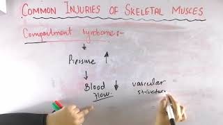 Compartment syndrome  Common injuries of skeletal muscle  Biomechanics of skeletal muscle [upl. by Montgomery]