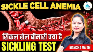 Sickle cell Anemia in hindi  Sickle cell test  Hematology Lecture  MLT Education Point [upl. by Omik]