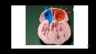 Development of Heart  Interventricular septum Bulbar septum and Aorticopulmonary septum [upl. by Tigdirb752]