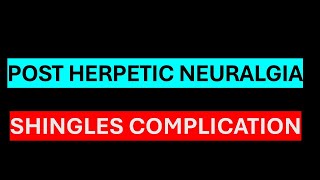 POST HERPETIC NEURALGIA [upl. by Adiari]