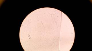 Darting motility of V cholerae 4 11 15MMIMSR C ngullie [upl. by Meelak]