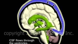 Hydrocephalus and Cerebrospinal Fluid CSF circulation by Dr Cal Shipley MD [upl. by Lesiram]