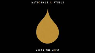 Rationale amp Ayelle  Hurts the Most Audio [upl. by Sokairyk]