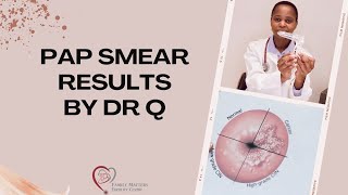 Explaining Pap Smear Results [upl. by Euqinahs608]