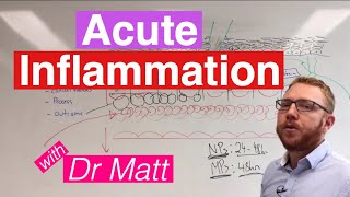 Acute Inflammation  Immunology [upl. by Islean]