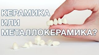 Керамика или металлокерамика что лучше выбрать [upl. by Rehportsirhc773]