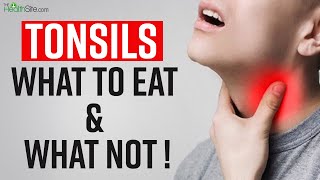 Tonsils Remedies What To Eat And What To Avoid In Tonsils  Sore Throat Treatment [upl. by Gnouc120]