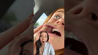 dental hygienist reacts to a seed stuck inside of someone’s cheek shorts [upl. by Hawthorn]