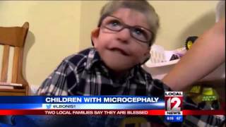 Medical Edge Children with Microcephaly [upl. by Sito161]