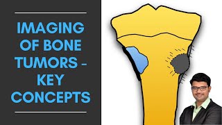 Imaging of Bone Tumors  Key Concepts  Dr Venkatesh Manchikanti ShadesofRadiology [upl. by Sylas]