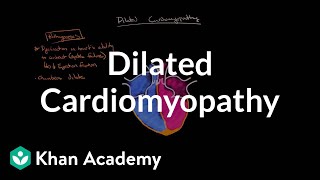 Dilated cardiomyopathy Pathophysiology and diagnosis  NCLEXRN  Khan Academy [upl. by Alisen]