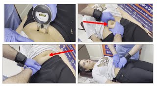 7 years old gas problem  navel displacement cured with chiropractic  chiropractic in Delhi [upl. by Htebharas]