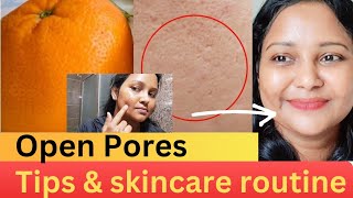 Open Pores  How to minimize Pores  Skincare Routine  tips for clear skin openpores homeremedy [upl. by Rika]