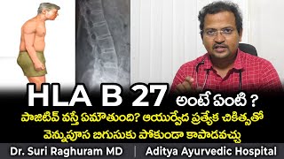 HLA B27  AYURVEDIC TREATMENT  ANKYLOSING SPONDYLITIS [upl. by Tatiana736]