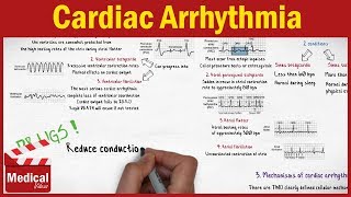 Pharmacology  Cardiac Arrhythmia and Antiarrhythmic Drugs FROM A TO Z [upl. by Alliber]