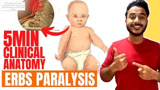 erbs paralysis clinical anatomy of brachial plexus  brachial plexus clinical anatomy [upl. by Aldrich843]