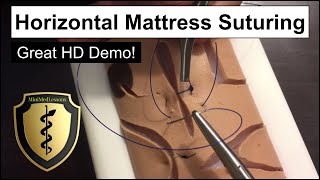 SUTURE Tutorial Horizontal Mattress Suture Technique Stepbystep instruction in HD [upl. by Neelie640]