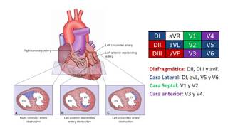 Medicina Interna Clase  Síndrome Coronario Agudo [upl. by Feil]