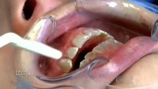 The Doctors Dr Bill Dorfman Transforms Severe Tooth Deterioration [upl. by Aniretak]