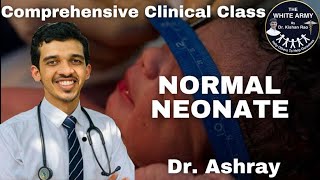 Normal Neonate case presentation [upl. by Eimas]