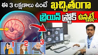 ఈ లక్షణాలు ఉంటే బ్రెయిన్ ట్యూమర్ ఉన్నట్లే  Brain Tumor Symptoms  Dr Shahidhar  iD Health 360 [upl. by Neelcaj954]