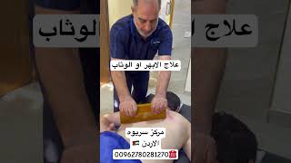 علاج الابهر او الوثاب او المتن مركز سريوهالاردن00962780281270 [upl. by Kinsley460]