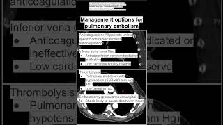 Management options for pulmonary embolism [upl. by Sara-Ann329]