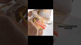 Basivertebral nerve ablation procedure [upl. by Meehaf]