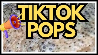 TikTok PIMPLES Popped [upl. by Cottrell]