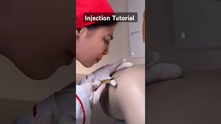 Injection Tutorial tutorial injection shorts littos [upl. by Asilana881]