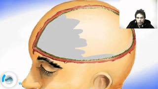 Brain Meninges  Dura Mater [upl. by Amelita635]