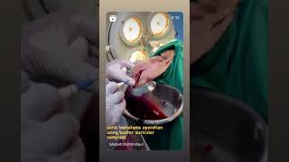 Aural hematoma operation using Buster Haematoma compress lykapetclinicdindigul [upl. by Leavy]