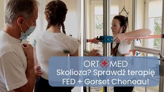 Leczenie skoliozy metodą FED z Gorsetem Cheneau  BIO Mariusz Czarnecki OrtoMed Bytom [upl. by Kinnon]