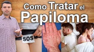 Casi Todos Tenemos VPH  Remedios NATURALES y Caseros Para Curar el Virus del Papiloma Humano [upl. by Keithley]