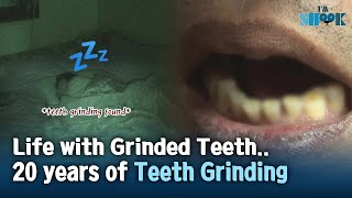 Teeth Grinding ASMR Attention All the Teeth Grinders The Risk or Bruxism [upl. by Eimmit825]